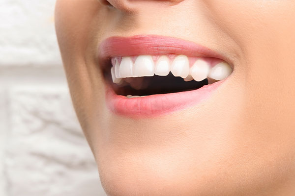 The image shows a smiling woman with straight white teeth, wearing red lipstick, against a blurred background.