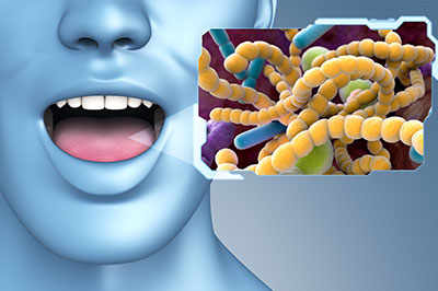 The image features a close-up of a person s face with an open mouth, displaying a yellowish substance that resembles bacteria or microorganisms.
