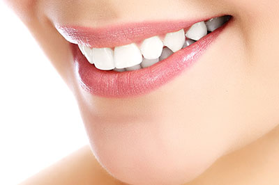 The image shows a close-up of a person s smiling face with teeth, focusing on their mouth and teeth.