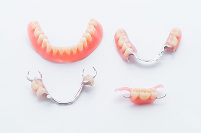 The image shows a collection of dental implants with visible teeth and gums, displayed against a white background.