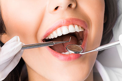 A woman with wide lips, having her teeth cleaned by a dental hygienist who is holding a mirror and a toothbrush.